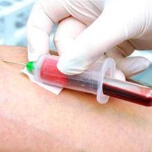 Уряд скасував щорічні спеціальні дозволи на реалізацію компонентів донорської крові і препаратів з неї 